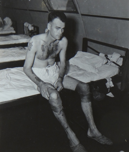 Robert L. Griffith, S1c USN, survivor of the USS Indianapolis in Naval Base Hospital No. 20, Peleliu, 5 August 1945.