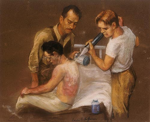 Two men treat another man with burns